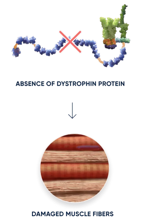 Absence of dystrophin protein and damaged muscle fibers