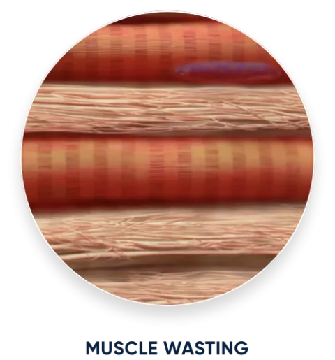 Muscle wasting