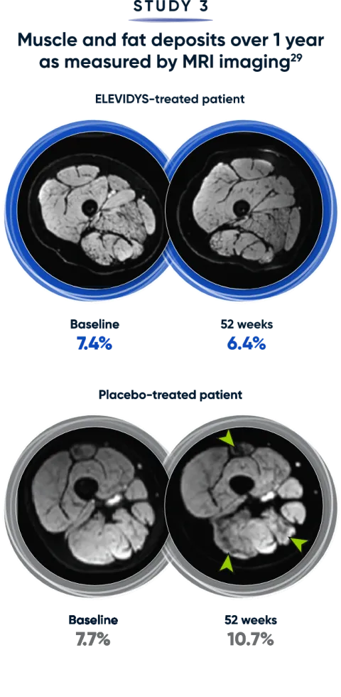 Muscle and fat deposits over 1 year as measured by MRI imaging